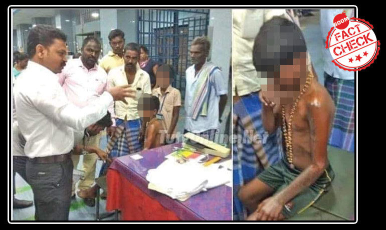 তামিলনাড়ুর স্কুল-ছাত্রের অ্যাসিডে পোড়া ছবি সাম্প্রদায়িক রঙ চড়িয়ে ভাইরাল হল তামিলনাড়ুর স্কুল-ছাত্রের অ্যাসিডে পোড়া ছবি সাম্প্রদায়িক রঙ চড়িয়ে ভাইরাল হল