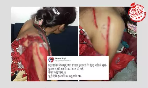 দিল্লির দাঙ্গায় হিন্দু মহিলা আক্রান্ত হওয়ার এই ছবিগুলি মিথ্যে দিল্লির দাঙ্গায় হিন্দু মহিলা আক্রান্ত হওয়ার এই ছবিগুলি মিথ্যে