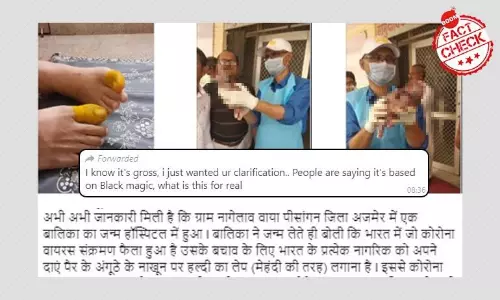 শিশুর জন্মগত অস্বাভাবিকতার ছবি মিথ্যে করে করোনাভাইরাসের সঙ্গে জোড়া হল শিশুর জন্মগত অস্বাভাবিকতার ছবি মিথ্যে করে করোনাভাইরাসের সঙ্গে জোড়া হল