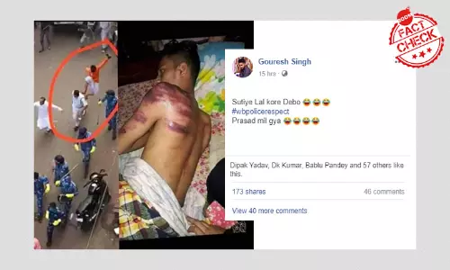 না, লকডাউন বিধিভঙ্গ করায় পশ্চিমবঙ্গ পুলিশের মারে আহত হয়নি এই যুবক না, লকডাউন বিধিভঙ্গ করায় পশ্চিমবঙ্গ পুলিশের মারে আহত হয়নি এই যুবক