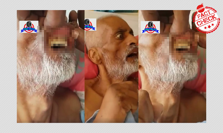 না, ভিডিওটি খৈনি খেয়ে প্রৌঢ়ের ঠোঁটের নীচে ম্যাগট সংক্রমণের ঘটনা নয় না, ভিডিওটি খৈনি খেয়ে প্রৌঢ়ের ঠোঁটের নীচে ম্যাগট সংক্রমণের ঘটনা নয়