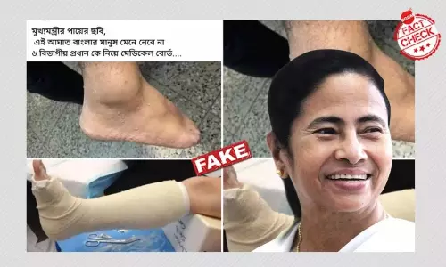 মমতা বন্দ্যোপাধ্যায়ের জখমি পা বলে ছড়ানো হল পুরনো ছবি মমতা বন্দ্যোপাধ্যায়ের জখমি পা বলে ছড়ানো হল পুরনো ছবি