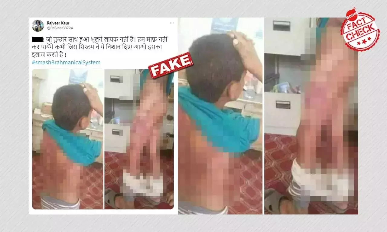 না, এগুলি গাজিয়াবাদে নির্মমভাবে নিগৃহীত বালকের ছবি নয় না, এগুলি গাজিয়াবাদে নির্মমভাবে নিগৃহীত বালকের ছবি নয়