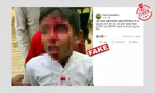 ২০১৯ সালে উত্তরপ্রদেশে আহত বালকের ছবি ছড়াল বাংলাদেশ পুলিশের মার বলে ২০১৯ সালে উত্তরপ্রদেশে আহত বালকের ছবি ছড়াল বাংলাদেশ পুলিশের মার বলে