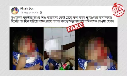 বাংলাদেশে আহত শিশুর পুরনো ছবি পশ্চিমবঙ্গে রাজনৈতিক হিংসা বলে চালানো হল