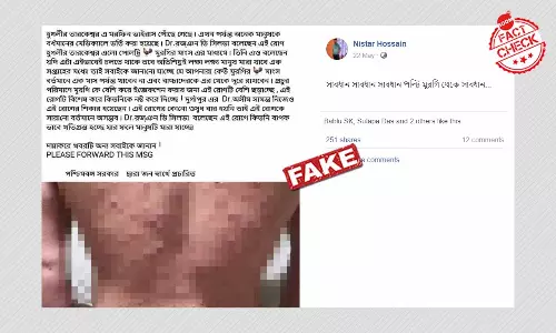 তারকেশ্বরে মরফিন ভাইরাসের প্রকোপ বলে জিইয়ে উঠল চিকেন পক্সের পুরনো ছবি তারকেশ্বরে মরফিন ভাইরাসের প্রকোপ বলে জিইয়ে উঠল চিকেন পক্সের পুরনো ছবি