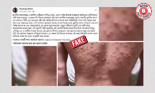 তারকেশ্বরে মরফিন ভাইরাস সংক্রমণ বলে ফের ছড়াল চিকেন পক্সের পুরনো ছবি তারকেশ্বরে মরফিন ভাইরাস সংক্রমণ বলে ফের ছড়াল চিকেন পক্সের পুরনো ছবি
