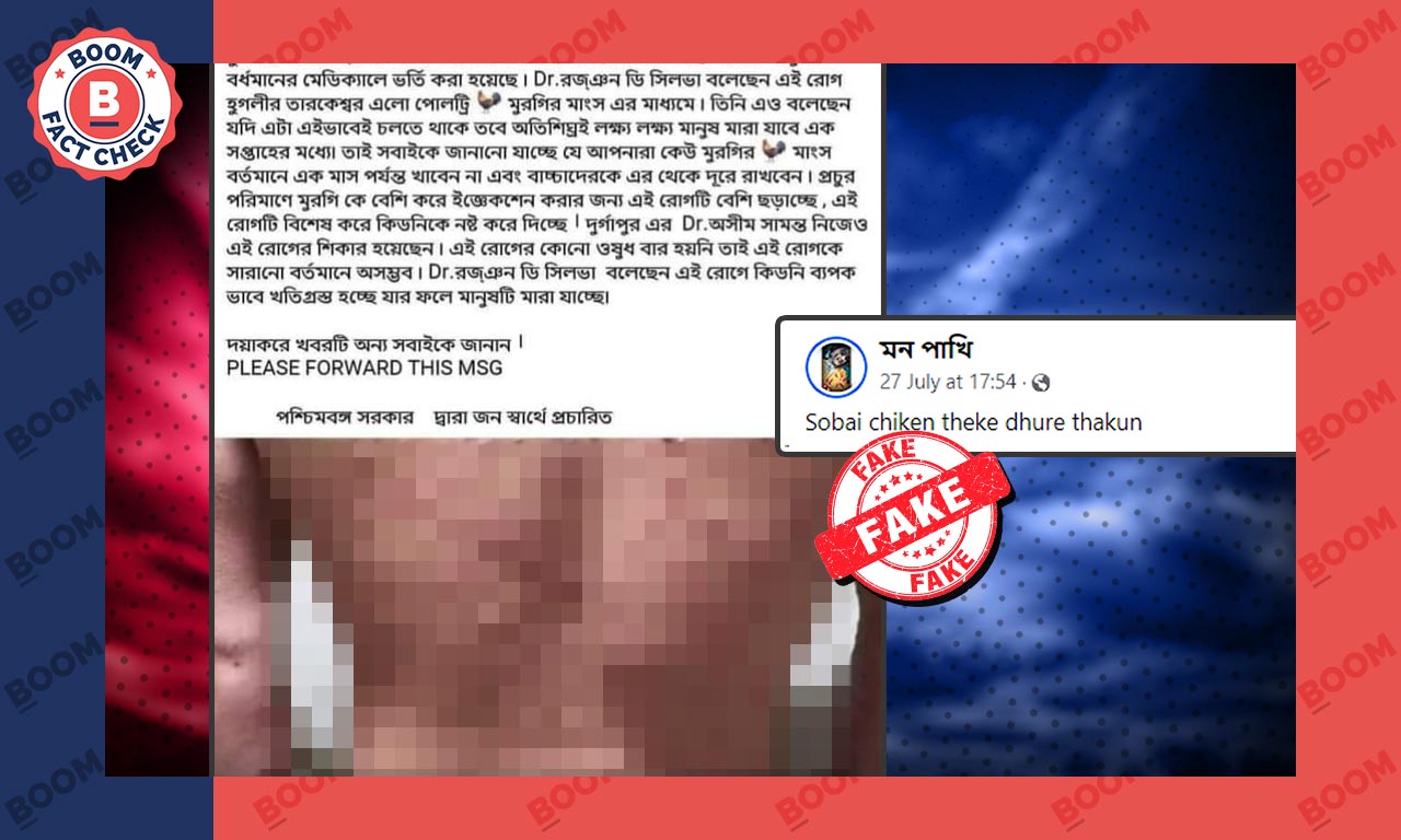 মরফিন ভাইরাসের প্রকোপ বলে ভুয়ো দাবিতে আবার ছড়াল চিকেন পক্সের পুরনো ছবি মরফিন ভাইরাসের প্রকোপ বলে ভুয়ো দাবিতে আবার ছড়াল চিকেন পক্সের পুরনো ছবি